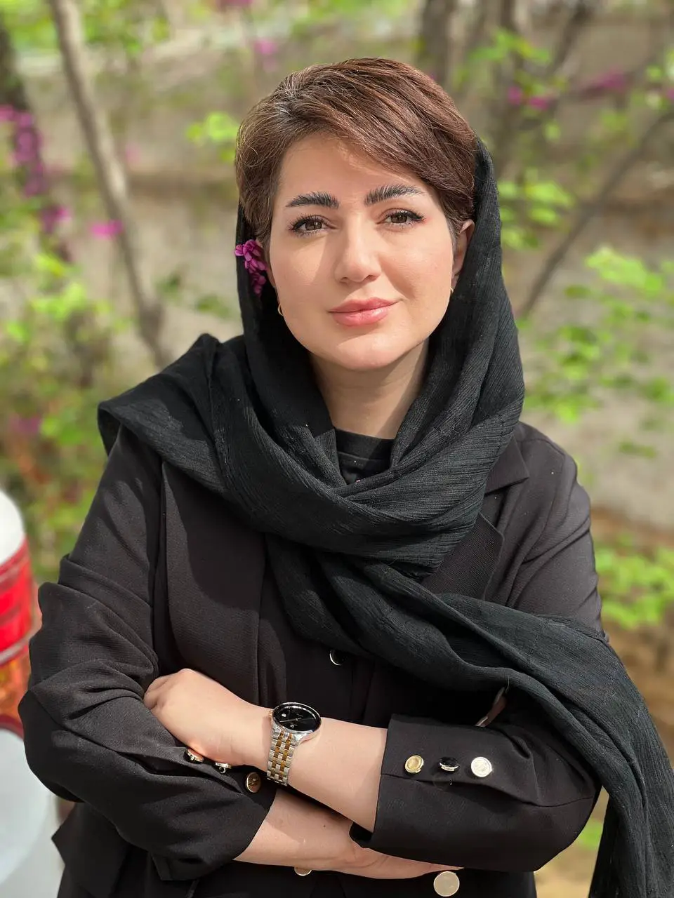 دکتر سارا سلطانی - کاشت مو سلطانیه